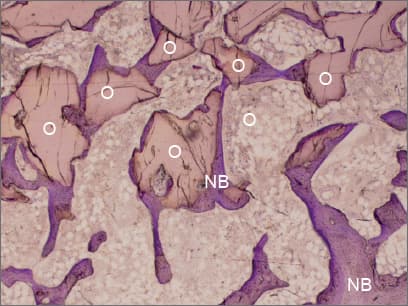 Histologie — 3 měsíce po implantaci